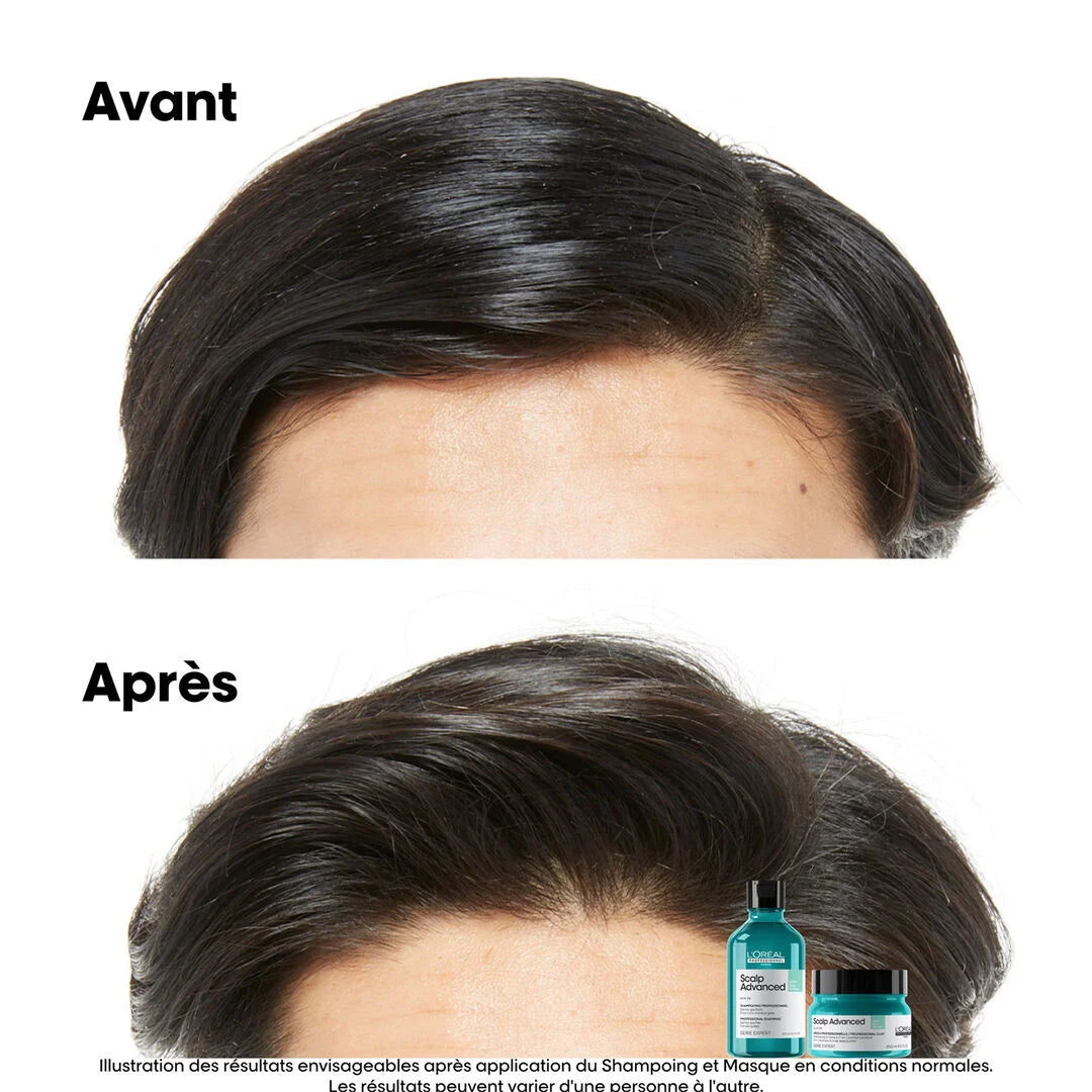 Shampoing Purifiant Scalp Advanced