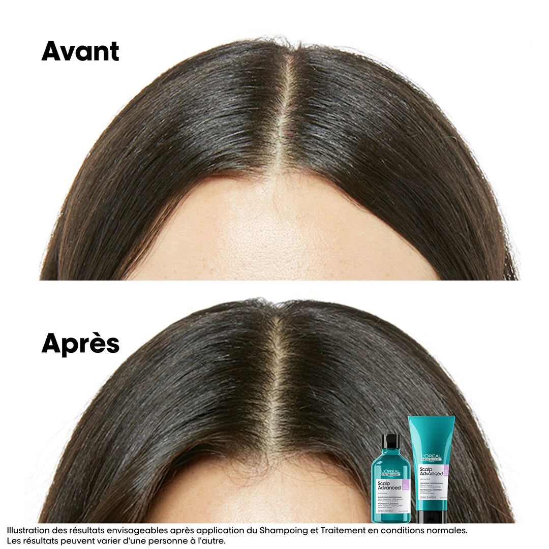 Shampoing Apaisant Dermo Scalp Advanced
