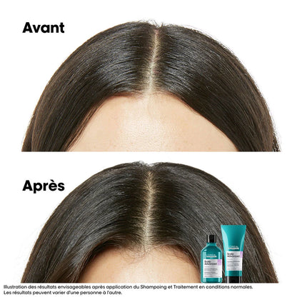 Shampoing Apaisant Dermo Scalp Advanced