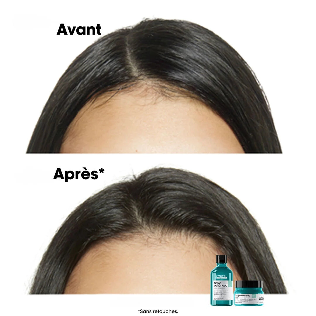 Shampoing Purifiant Scalp Advanced
